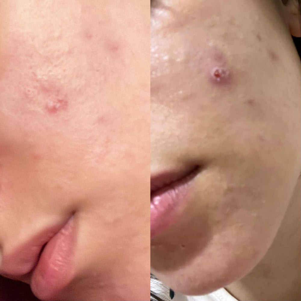 Bloom customer review