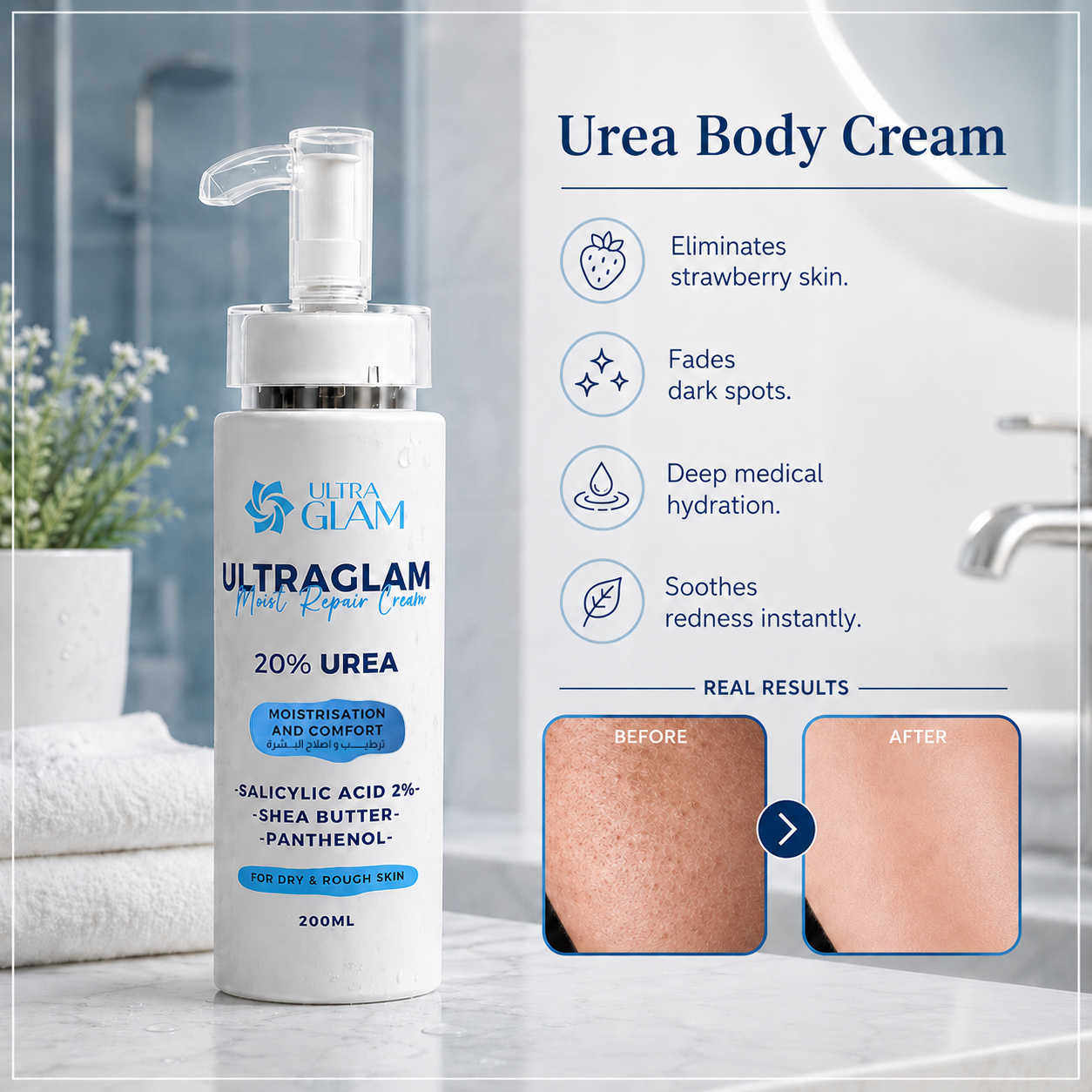 Urea cream 20%